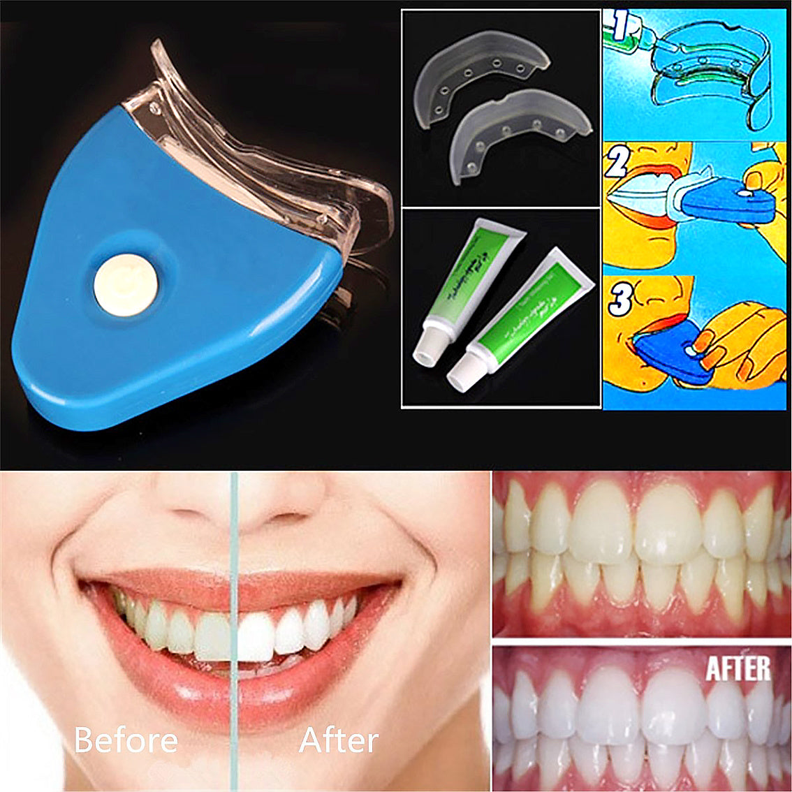 Teeth Whitening Oral Gel
